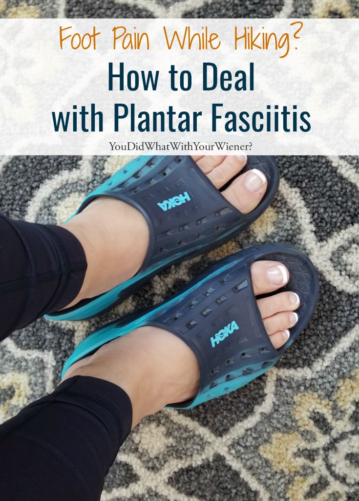 Plantar Fasciitis could keep me from hiking with my dog
